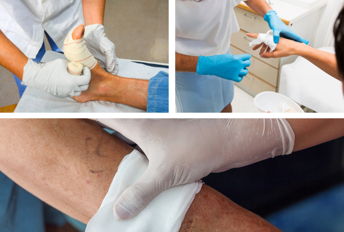 About - Advanced Wound Care Dressing