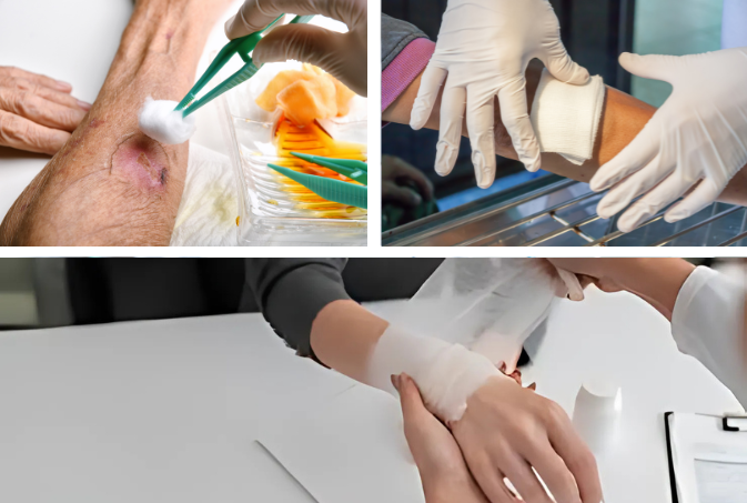 Wound Dressing Services at Home - Advanced Wound Care Dressing 