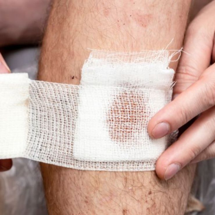 Silver Dressing - Advanced Wound Care Dressing